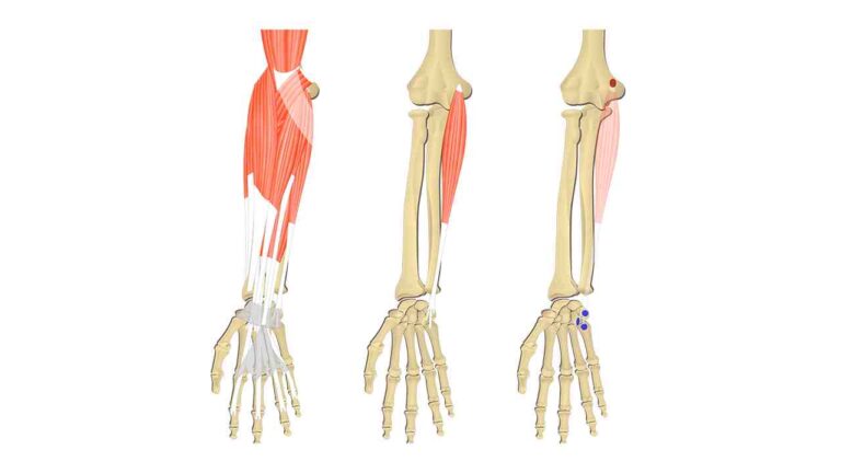 Flexor Carpi Ulnaris