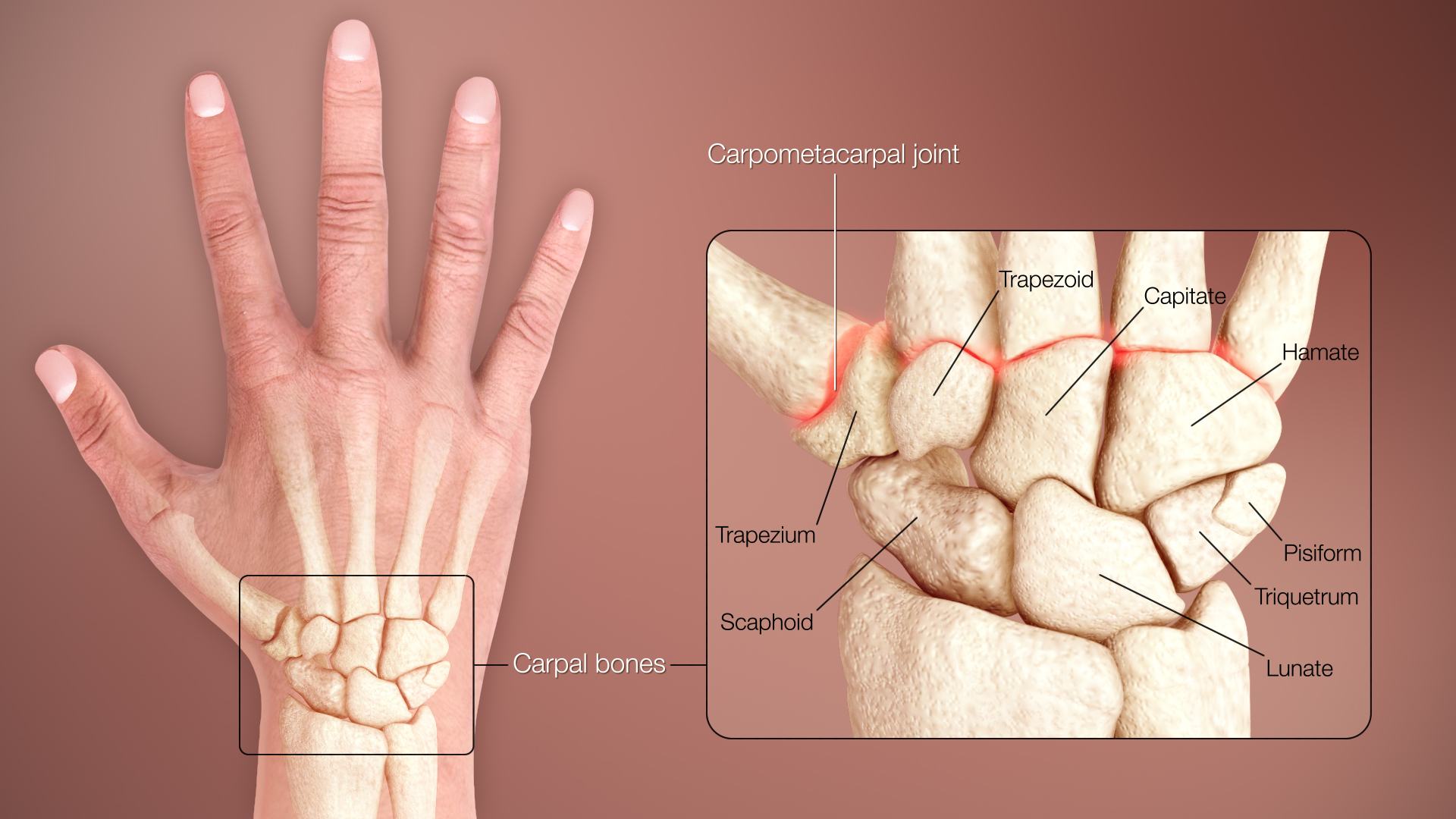 Joints – wrist