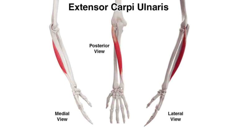 Extensor Carpi Ulnaris