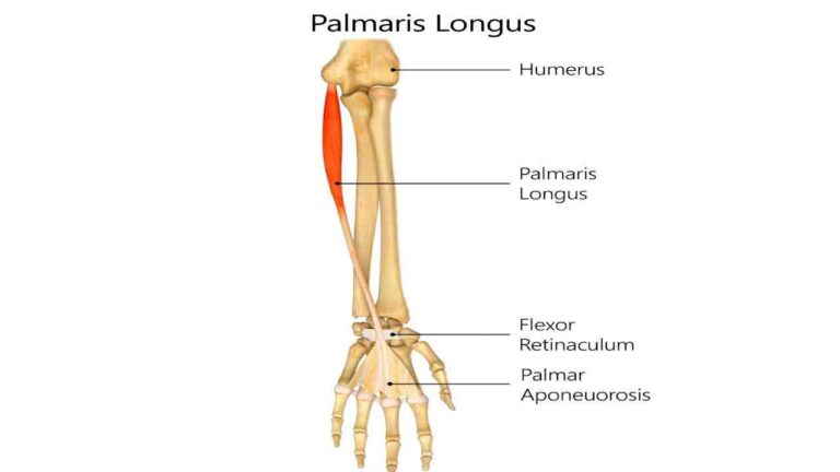 Palmaris Longus