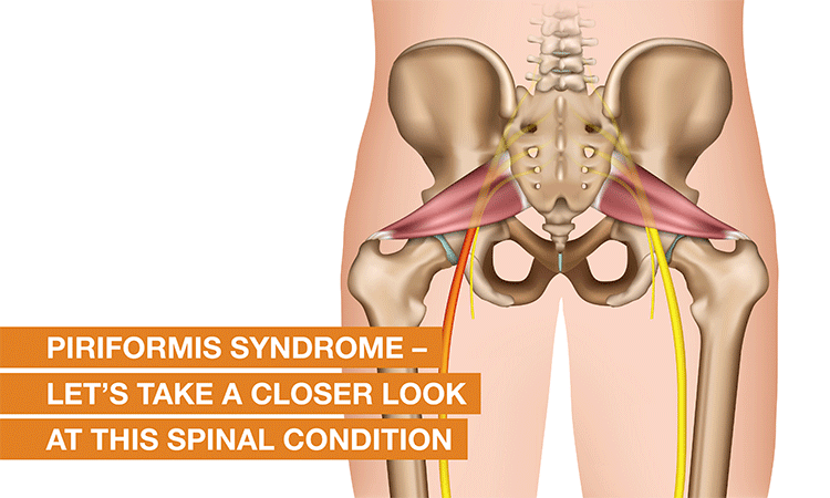 Piriformis