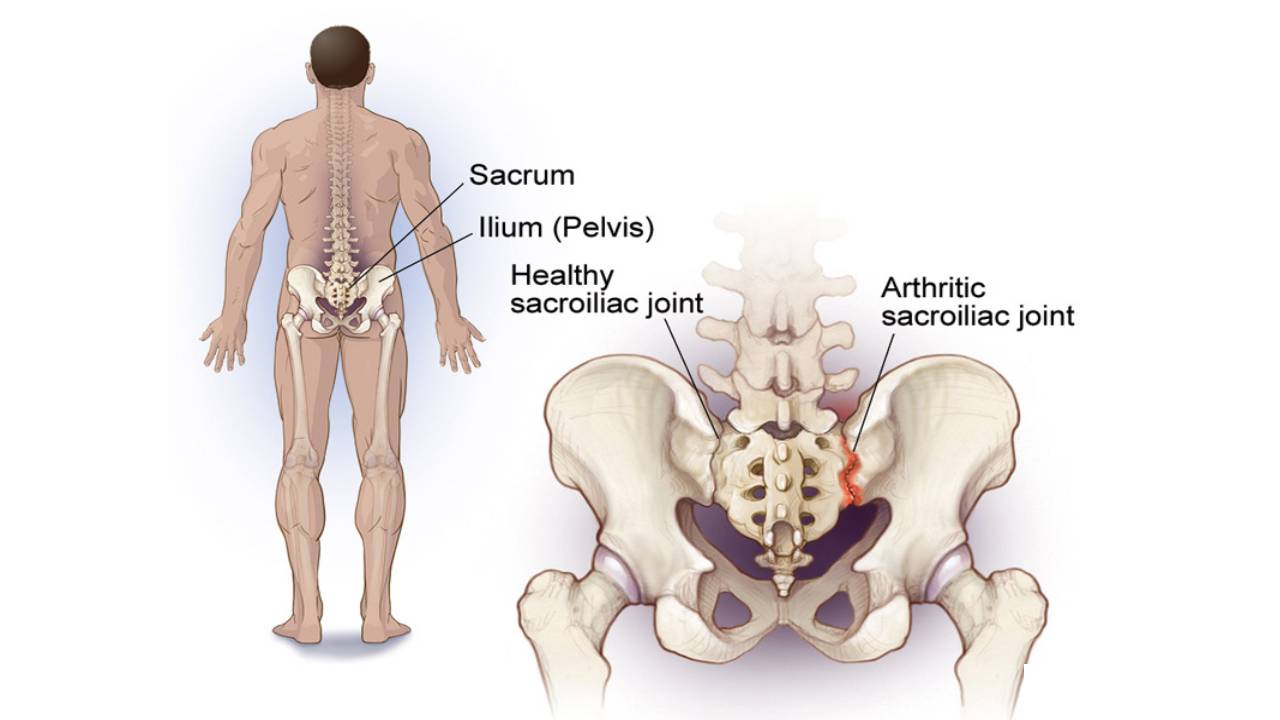 Joints Sacroiliac