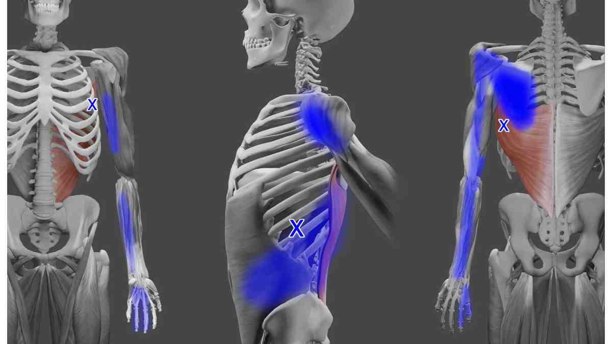 Upper Extremity Region ARM – latissimus Dorsi