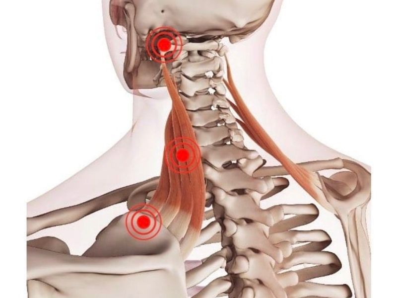 Levator Scapulae